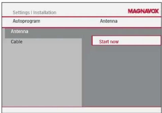 Settings | Installation MAGNAVOX Autoprogram Antenna Antenna Cable Start now