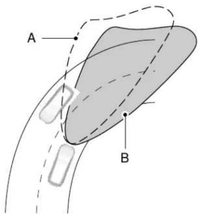 A B