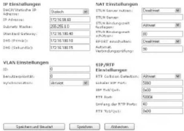 AGFEO DECT IP-Basis XS - Erweiterte Einstellung: IP-Adress Vergabe - 2