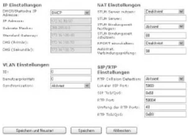 AGFEO DECT IP-Basis XS - Erweiterte Einstellung: IP-Adress Vergabe - 1
