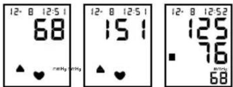 12· 8 12:51 68 ▲ ♥ mmHg mmHg 12· 8 12:51 151 ▲ ♥ mmHg 12· 8 12:52 125 76 mmHg 68