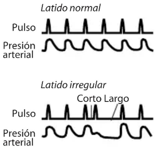 OMRON BP791IT - SÍMBOLO DE LATIDO IRREGULAR ( - 1