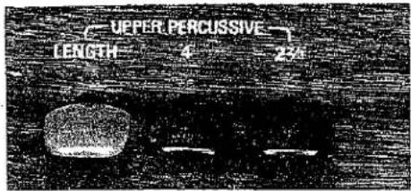 UPPER PERCUSSIVE LENGTH 4 2.4