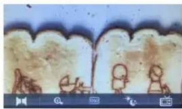 Microscopic view of biological tissue with stained cells and human figures (no text or symbols visible)