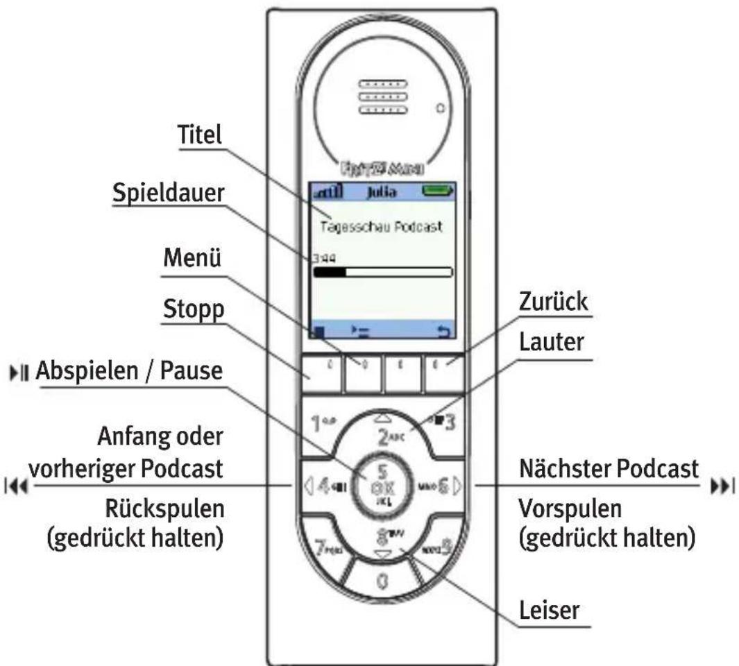 AVM FRITZ!Mini - Podcast anhören - 1