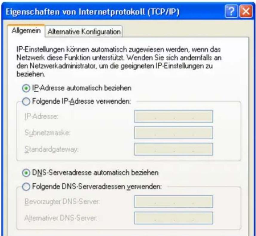 AVM FRITZ Fon 7150 - IP-Adresse automatisch beziehen in Windows XP - 1