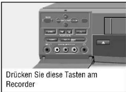 Drücken Sie diese Tasten am Recorder