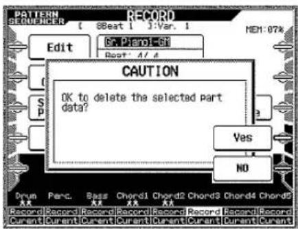 CASIO MZ-2000 - Löschen aller Parts in der Aufnahmebereitschaft - 1