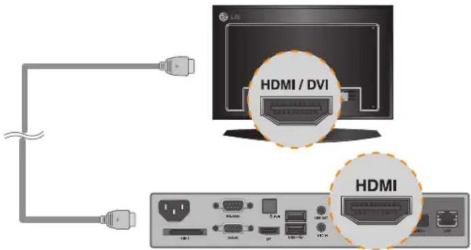 LG NA2000 - Attention - 2