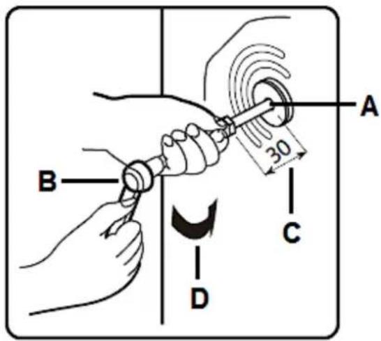 PKM WT9+6 - Entfernen der Transportsicherungsbolzen - 2