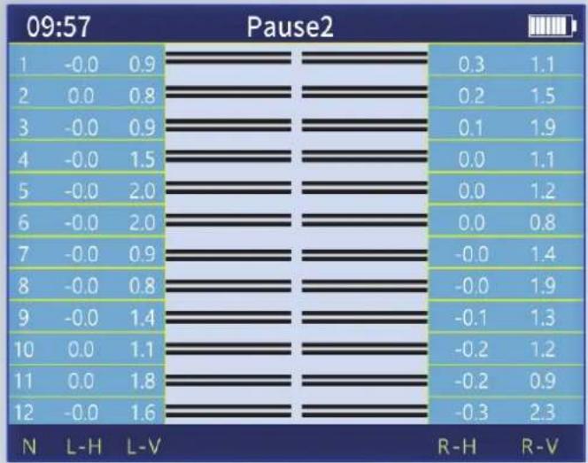 JILONG KL-400 - Advantages - 8