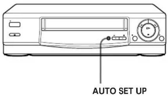 AUTO SET UP