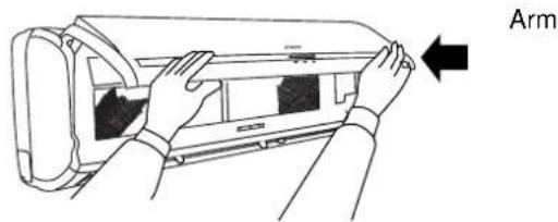 Arm