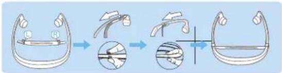 Diagram illustrating a medical procedure for catheter placement, showing steps from initial placement to final placement with magnified views.