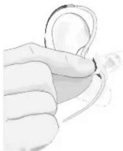 Sonic BL100 MN Bliss - Putting On Your Hearing Instrument – Thin Tube - 2