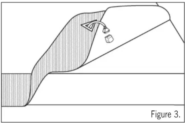 SUNBEAM Sleep Perfect BL5681 - Connecting the controls - 1