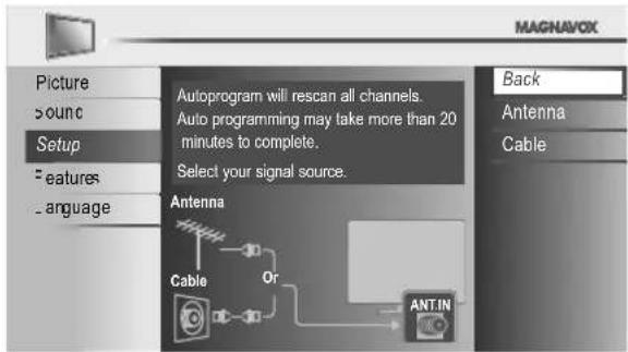MAGNAVOX 40MF430B - Before you beg in: - 1