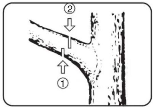 Diagram showing two labeled parts (① and ②) with arrows indicating flow or movement between them, likely illustrating a geological or material process.