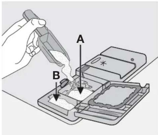 Diagram illustrating a dental implant procedure with labeled components A and B, showing tool insertion and component placement.