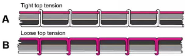 Tight top tension A Loose top tension B