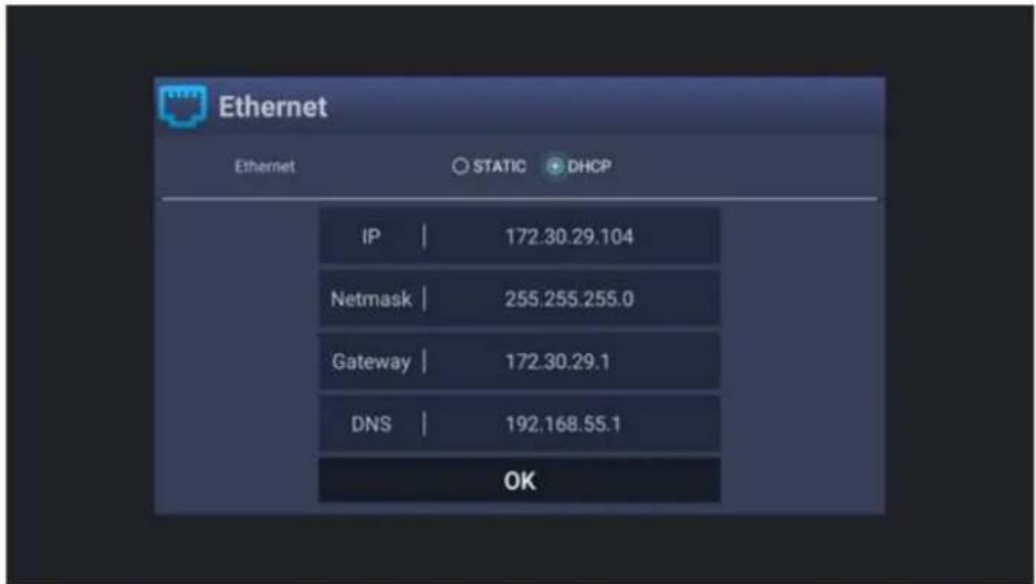 Laser MMC-X40 - Cable connection to the internet using a Modem/Router - 1