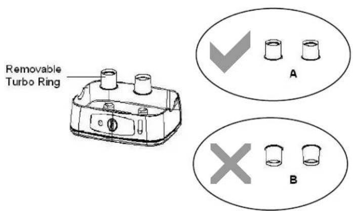 Removable Turbo Ring ✓ A × B