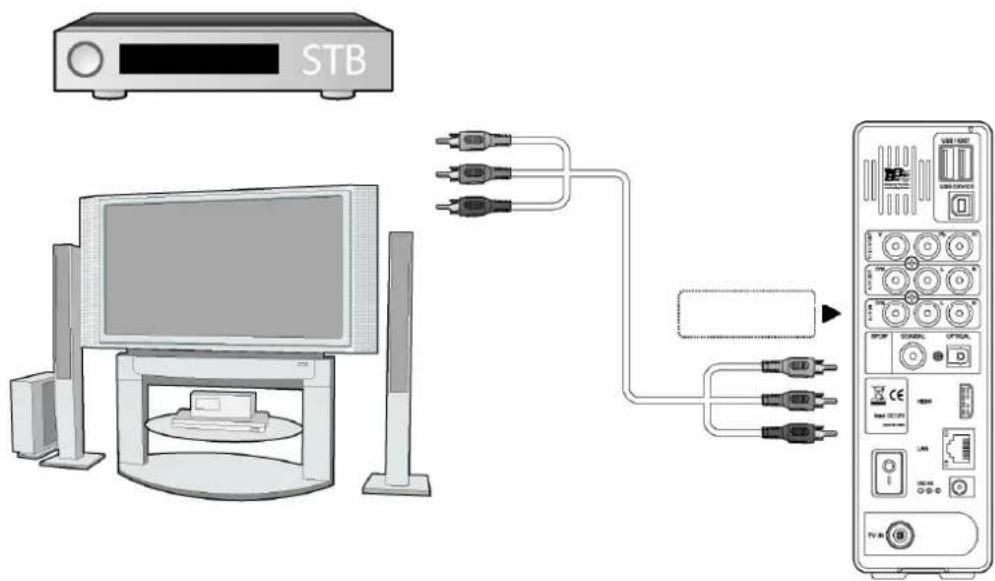 STB