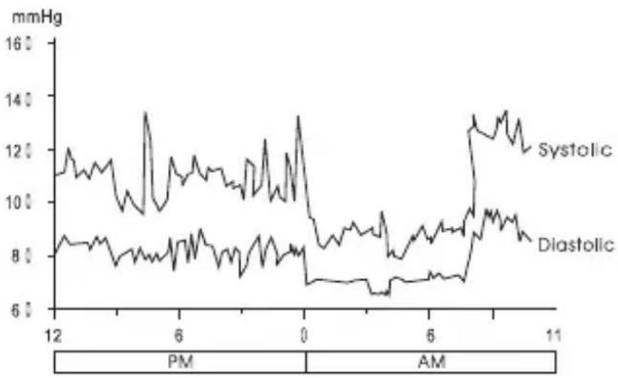 IC Intracom Desktop - Fluctuation and variation in blood pressure - 1