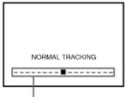 NORMAL TRACKING