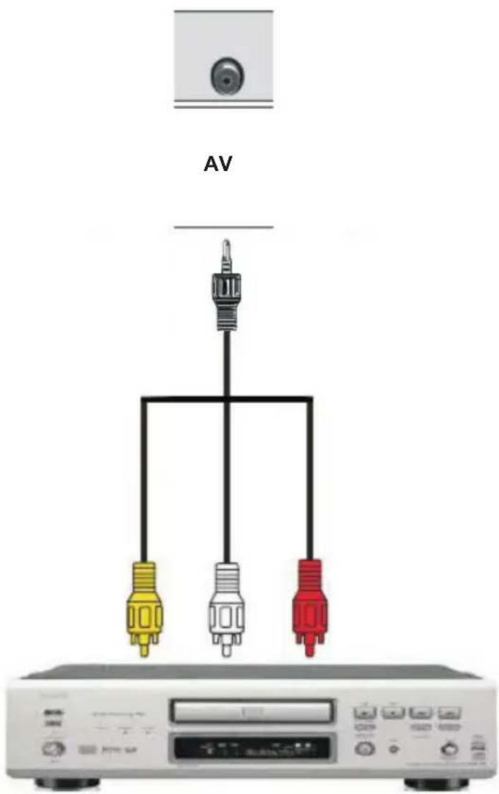 AV