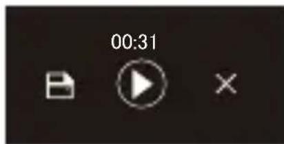 00:31