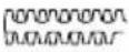 Tanaka TCH 24EA - ความหมายของสัญลักษณ์ - 4