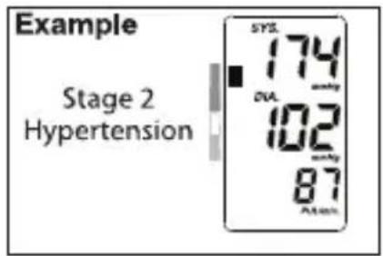Example Stage 2 Hypertension SYS. 174 DVL 102 mL/kg 87 mmHg