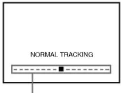 NORMAL TRACKING