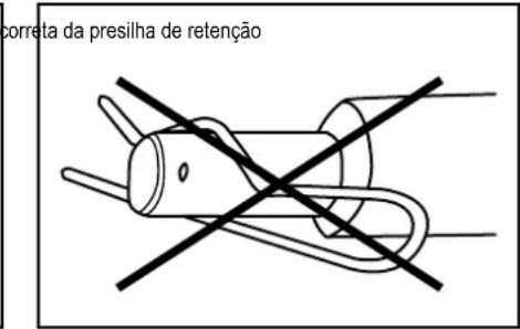 correta da presilha de retenção