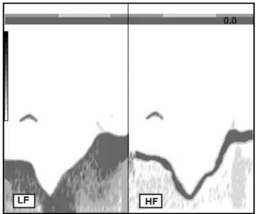 LF HF 0.0