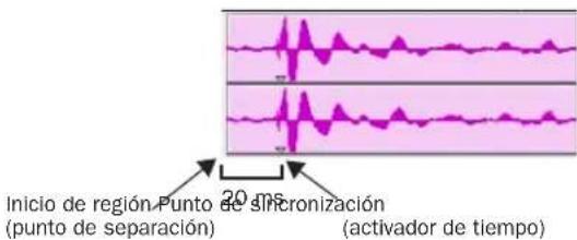 Inicio de región Punto de sincronización (punto de separación) (activador de tiempo) 20 ms