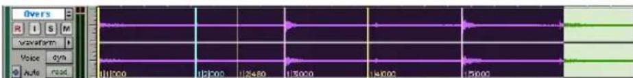 Overs I S M waveform Voice dyn Auto read 11000 12000 12450 13000 13500 14000 15000