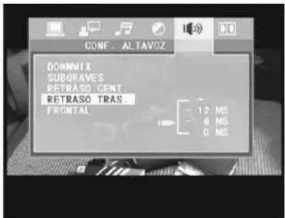 TELEVES 7141 - Frontal - 4