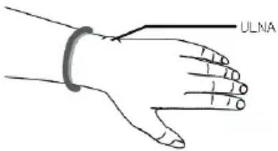 ULNA