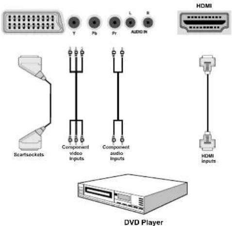 Scartsockets Component video inputs Component audio inputs HDMI DVD Player