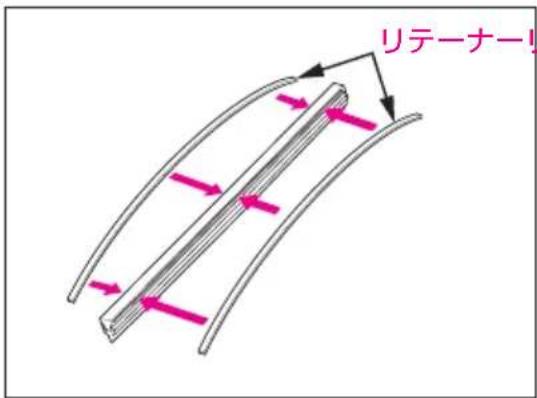 リテーナー!