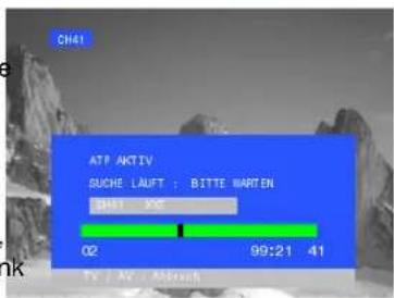 PANASONIC TX-25SL1FZ - Haben Sie alle Zubehörteile und sonstige hier abgebildeten Teile? - 13