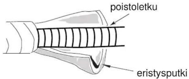 poistoletku eristysputki