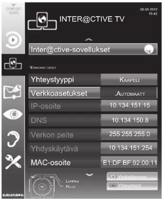 GRUNDIG 40 VLE 6339 BR - Automaattinen yhteys - 1