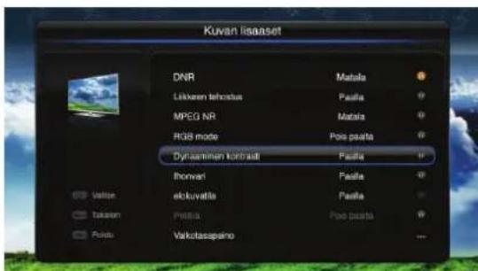 PIONEER L40S3D13N - Dynaaminen kontrasi - kuva - lisäasetukset - 1