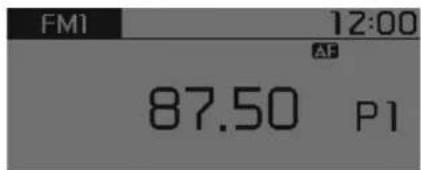 FM1 12:00 AF 87.50 P1