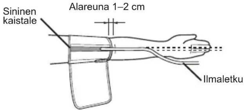 Sininen kaistale Alareuna 1–2 cm Ilmaletku