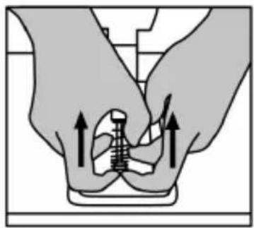 Illustration of two hands performing a medical procedure on a patient's chest with arrows indicating pressure or movement (no text or symbols)