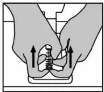 Illustration of two hands performing a medical procedure with an anatomical model. No text or symbols present.